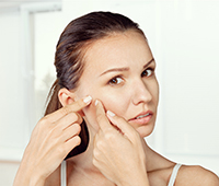 Acne in pregnancy Ayurvedic treatment